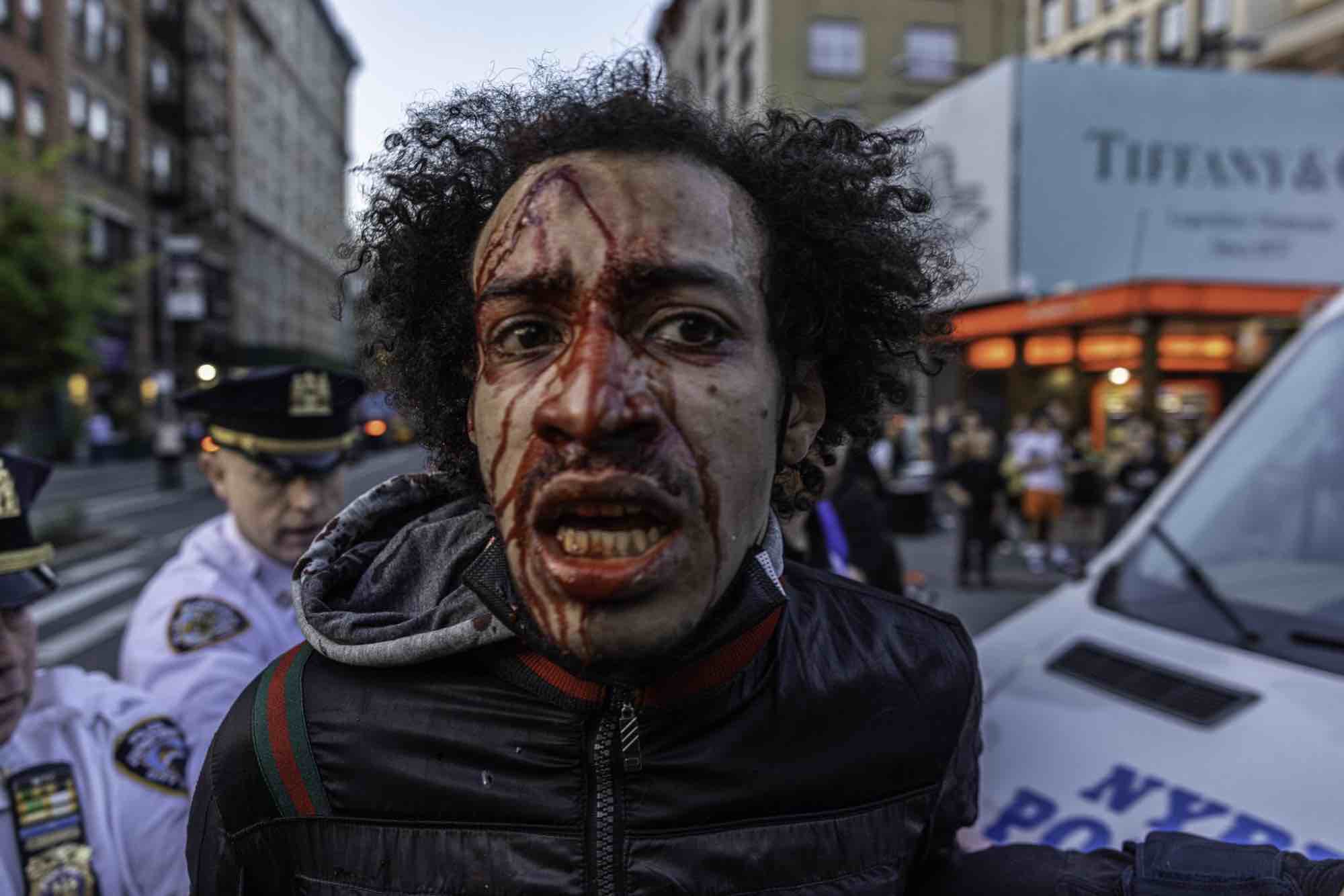 The bloody face of someone arrested at a vigil for Jordan Neely on May 8, 2023.